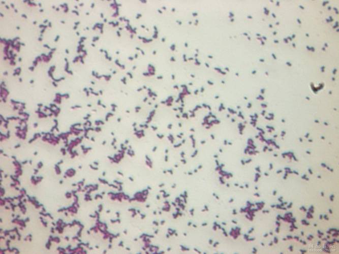请各位朋友帮我看看这是不是革兰氏染色后的大肠杆菌,谢谢
