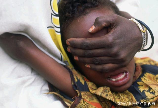 正在接受割礼的非洲女孩