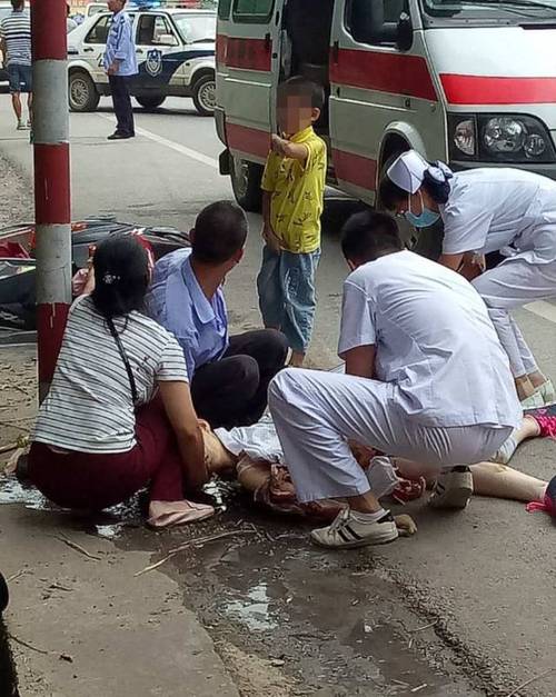 桂林一十几岁小女孩发生一起惨烈车祸,肠子都出来了!
