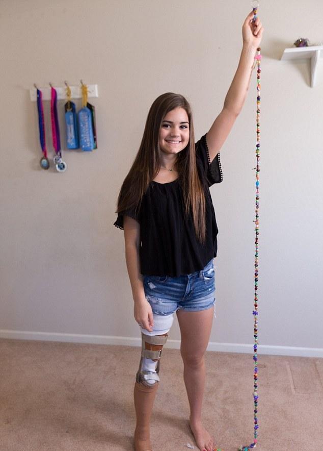 14岁励志女孩,膝盖患癌手术后小腿上移用脚踝当膝盖,坚持跳舞