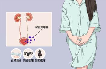 尿道口红肿,流分泌物等症状,并且此病还可导致非淋菌性尿道炎,前列腺
