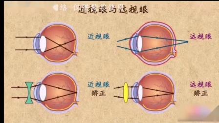 眼球的结构功能及近视眼的形成原因
