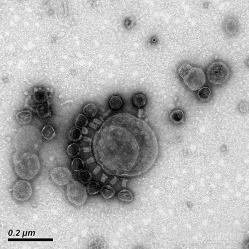 炭疽杆菌噬菌体