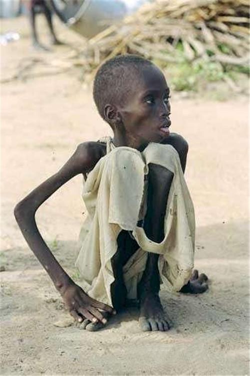 南非摄影师卡特:用生命拍下苏丹的饥饿小女孩,最后活下来了吗?