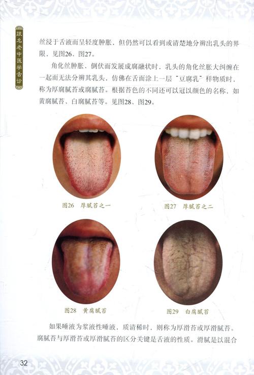 临床实用舌象图谱中医舌诊临床图解跟名老中医学舌诊修订版3本套装