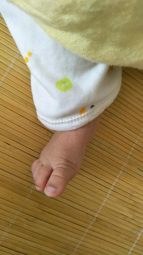 宝宝脚趾头有点黑