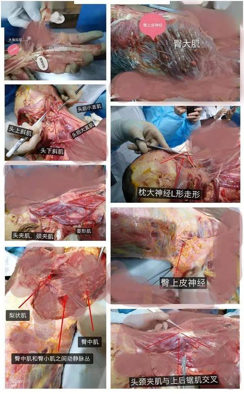 【11月27日-郑州】针刀微创新鲜人体解剖及疼痛科临床实战精讲班