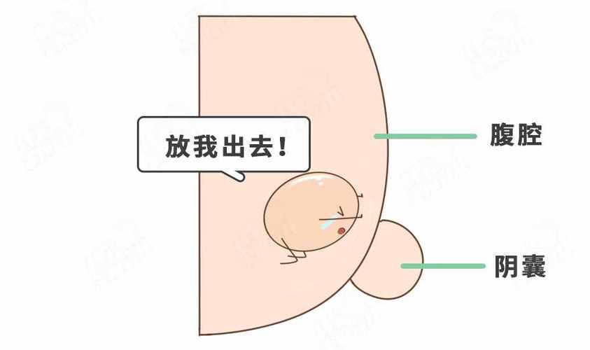 睾丸一个大一个小是怎么回事一个睾丸特别大一个特别小