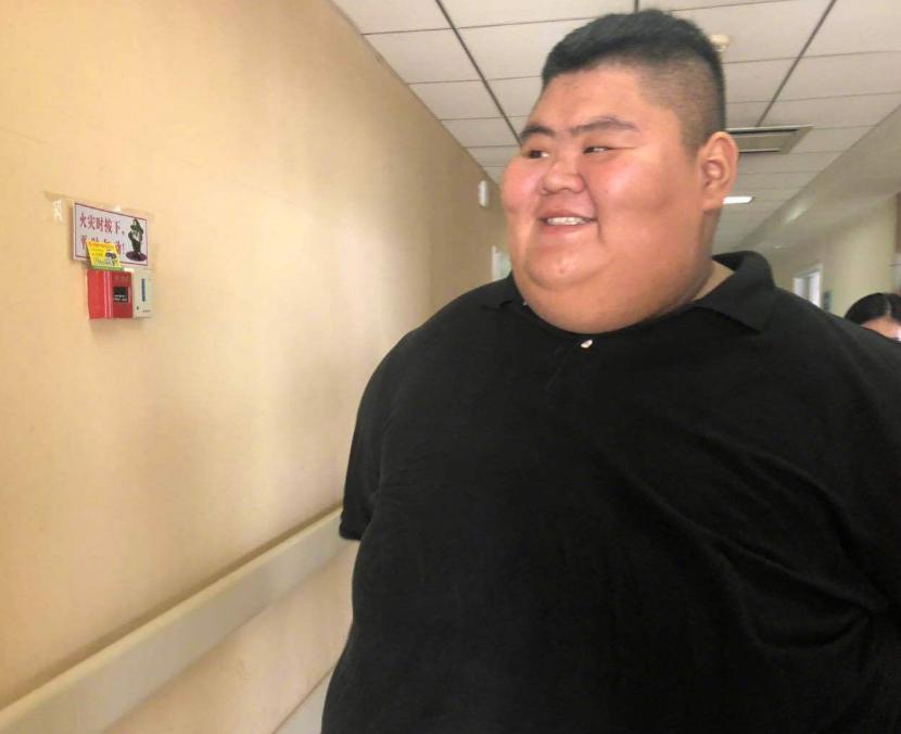 "我国第一胖"王浩楠,小学就300斤,为爱情减363斤,现在成这样