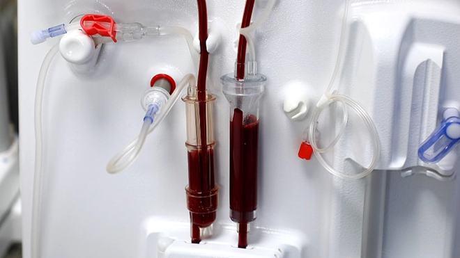 威高血液净化全新重磅机型首批装机使用!|透析|透析机|治疗_网易订阅