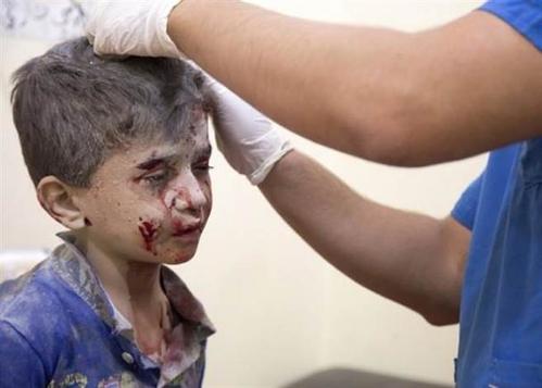 叙俄合力狂炸阿勒坡 百人死亡孩童无一幸免