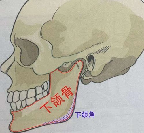 下颌角手术留角后悔了解析下颌角削骨到底需不需要留角