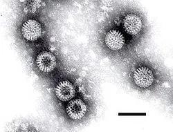 电子显微镜下的轮状病毒,黑线长度为100纳米