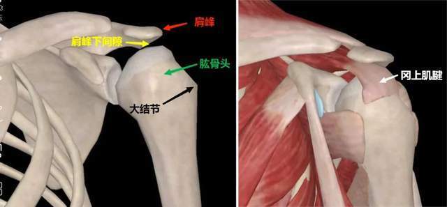肩峰撞击综合征相关的几个重要结构:肩峰,冈上肌腱,肱骨大结节,肩峰下