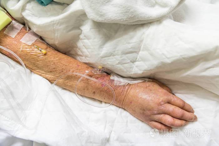 病人亚洲老年妇女80岁生理盐水静脉注射在c线或一条线上的老年病人手