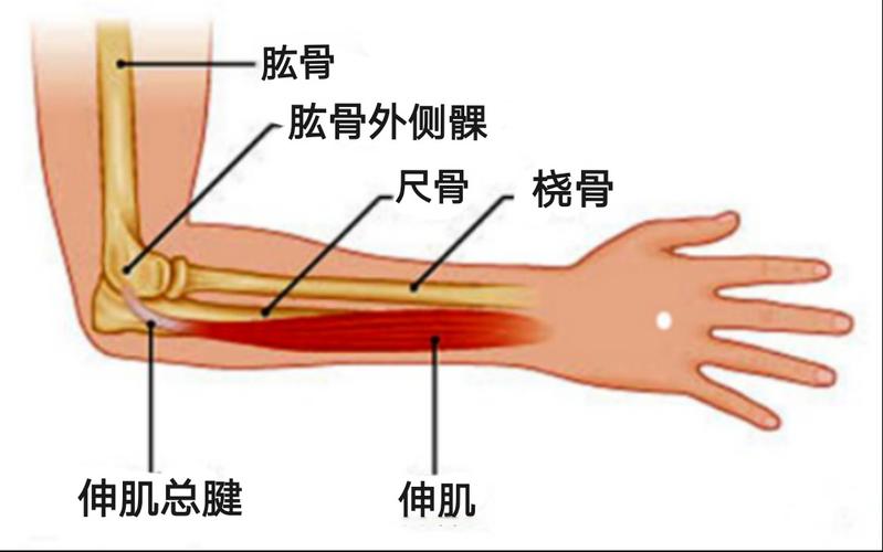 肘部外侧疼痛,灼热,握力减弱,个别患者活动前臂时会有肘关节弹响.