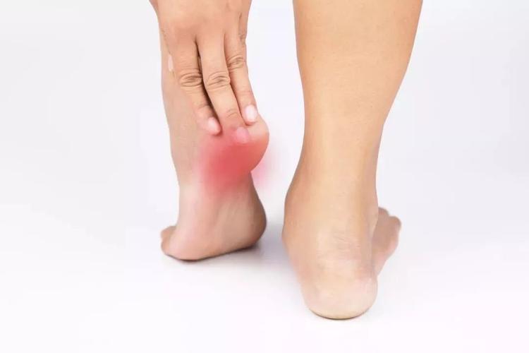 关于养生你要知道,脚后跟痛是怎么一回事?