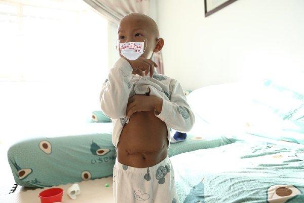 三岁男童被切除两斤重肿瘤