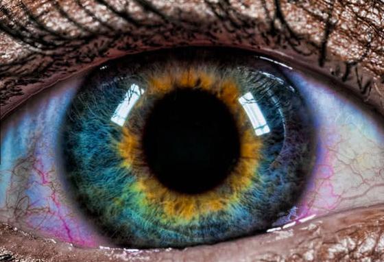 你听说过「虹膜异色症」(heterochromia iridum)吗?