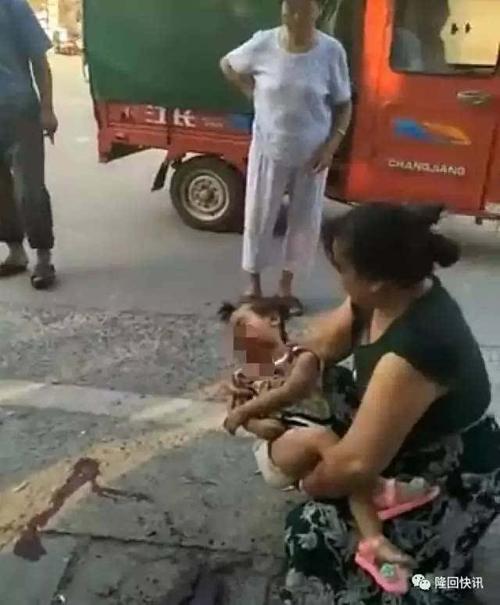 南岳庙乡一小孩被车撞伤势严重,肇事者当场逃离