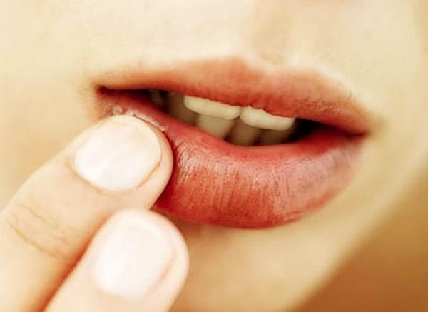 嘴唇老是干燥脱皮连吃饭喝水都痛到底是什么原因呢