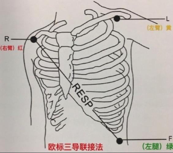 电极 具体位置 左臂电极(l) 左锁骨中线锁骨下或左上肢连接躯干的