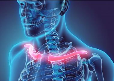 的姿势骨性关节炎关节损伤胸廓出口综合征断裂锁骨疼痛的常见原因包括