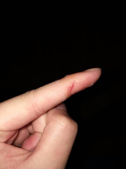 问题昨天被带有一点锈的铁 划破了手指 伤口不是很深 出了一点血就没