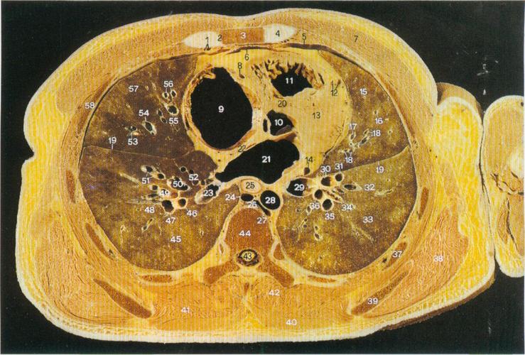 图5-13 经主动脉口的横断层-人体断层解剖学-医学