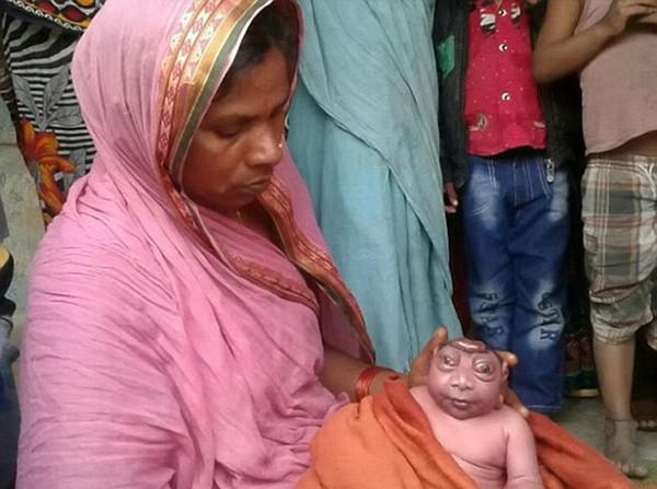 印度女子产下无脑巨眼怪婴当地人奉若神明组图