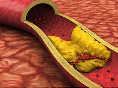可以在血管,气管,肠道等管道里"入住",这就是我们平时所说的管道脂肪