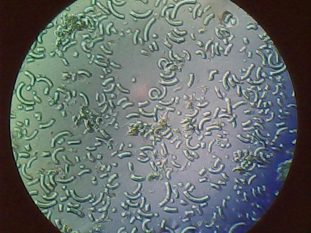 螺旋藻片水浸液镜下图片(400倍),求鉴定真假