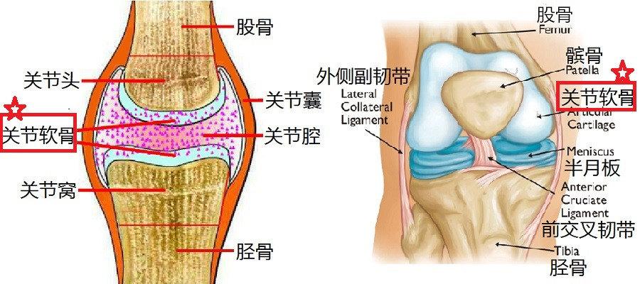 膝关节软骨损伤怎么办
