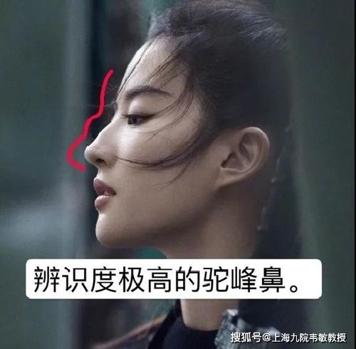 上海九院韦敏丨极具个人特色的驼峰鼻需要矫正吗?