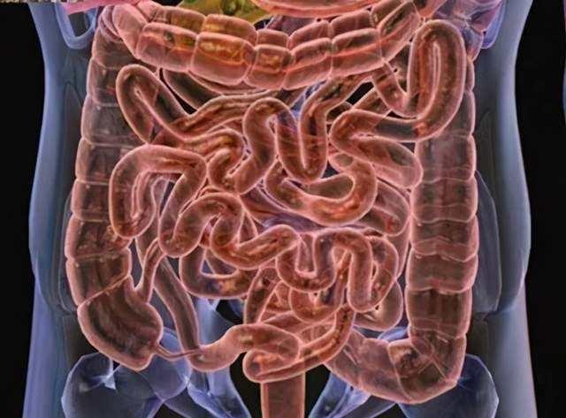 人的肠子结构图