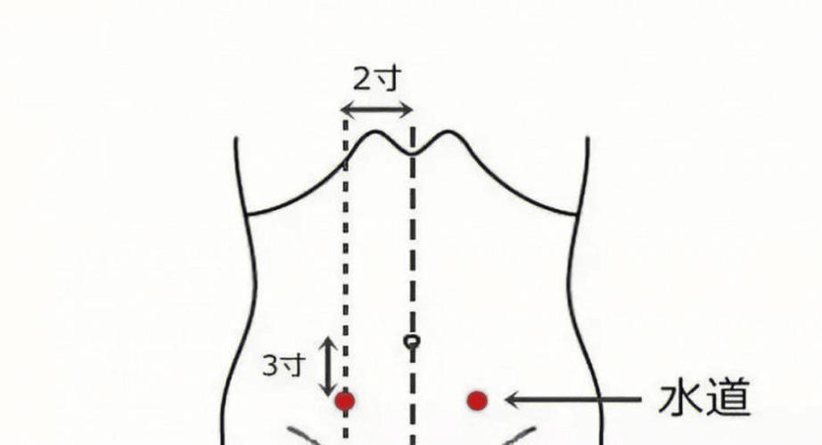 1,水道穴:在腹部肚脐旁开两寸下三寸,轻轻揉搓按摩可缓解小腹胀痛;-2