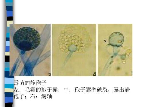 霉菌的静孢子 左:毛霉的孢子囊;中:孢子囊壁破裂,露出静 孢子;右:囊轴
