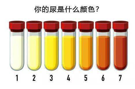 尿液颜色变化一般正常情况下,正常人每日的尿量在1000至2000毫升