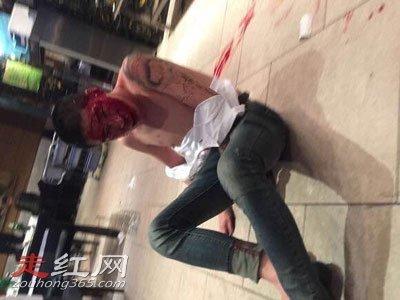 刘一手被打一脸血视频怎么回事在北京被人打纯属偶然