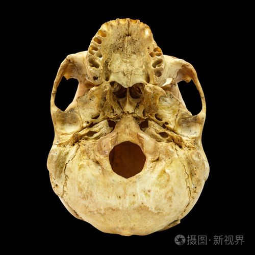 人类头骨 fracture(beneath) (蒙古人种,亚洲) 孤立的背上