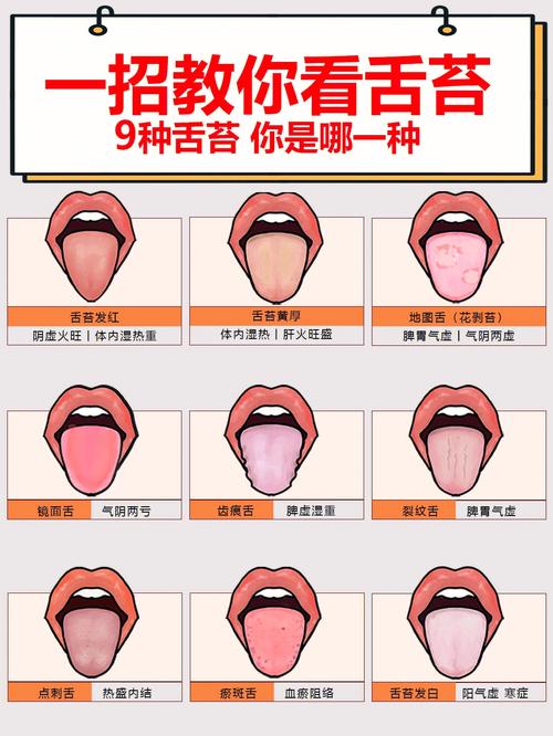 一招教你看舌苔常见9种舌苔图对应内在