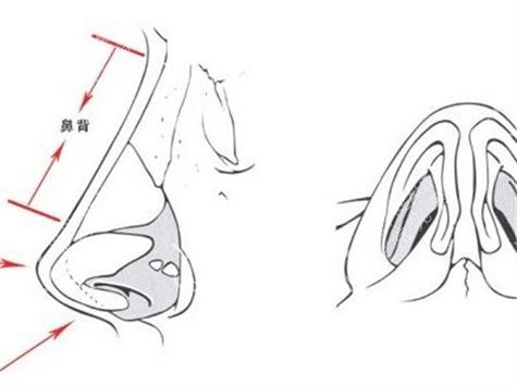 鼻背结构示意图