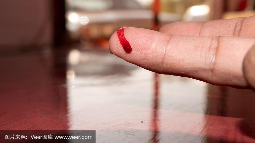人手上的一根手指被划伤,流着鲜红的血