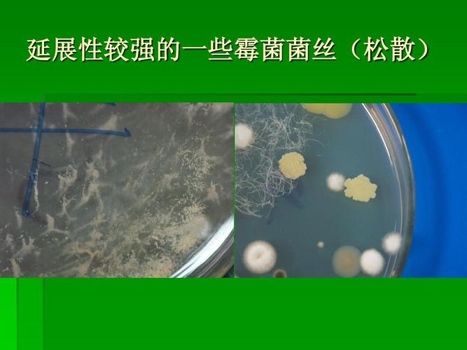你可能喜欢 微生物图谱 微生物技术 微生物总结 细菌鉴定 真菌培养