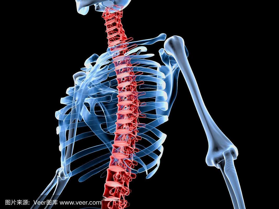 3d渲染医学上精确的骨骼与疼痛的背部脊椎的插图