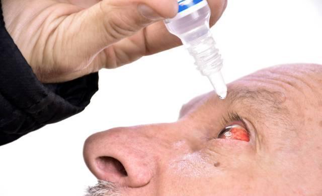 过敏性结膜炎发作眼睛越揉越痒怎么办教你一招止痒