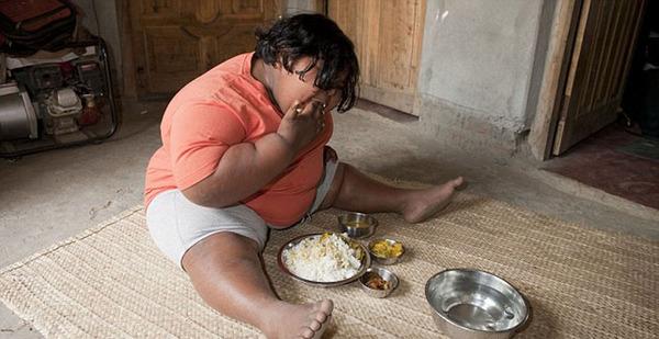 印度9岁女孩体重超180斤 每周吃掉180根香蕉(图)