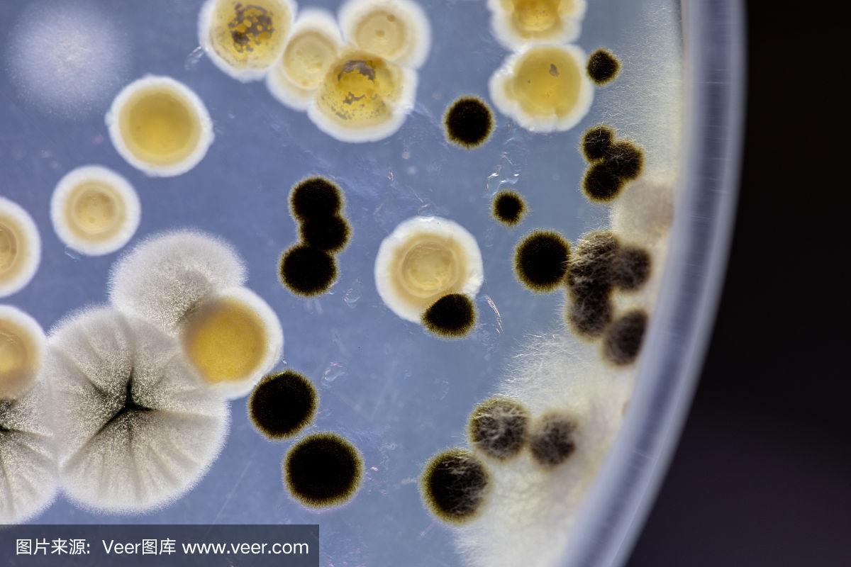 土壤样品琼脂平板上细菌和霉菌的特性及不同形态菌落背景,供微生物学