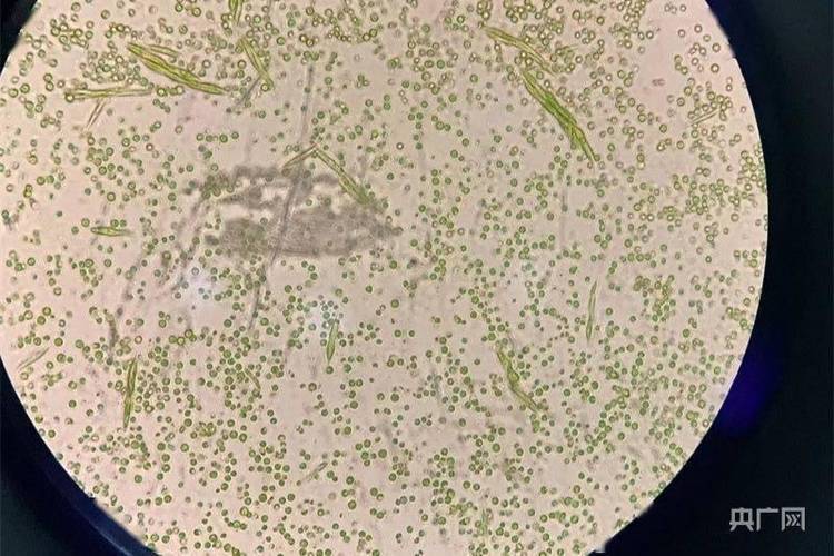 显微镜下的藻类(央广网发 肖江峰摄)