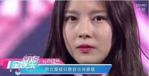 韩女星在节目上捏了一下鼻子,鼻子居然塌了··(Д≡Д)